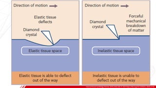 Interventional Cardiology Review 2019;14(3):182–9. DOI:https://doi.org/10.15420/icr.2019.17.R1
B
 