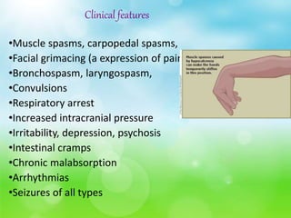 Clinical features
•Muscle spasms, carpopedal spasms,
•Facial grimacing (a expression of pain)
•Bronchospasm, laryngospasm,
•Convulsions
•Respiratory arrest
•Increased intracranial pressure
•Irritability, depression, psychosis
•Intestinal cramps
•Chronic malabsorption
•Arrhythmias
•Seizures of all types
 