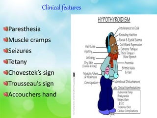 Clinical features
Paresthesia
Muscle cramps
Seizures
Tetany
Chovestek’s sign
Trousseau’s sign
Accouchers hand
 
