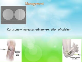 Management
Cortisone – increases urinary excretion of calcium
 