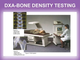 DXA-BONE DENSITY TESTING
 