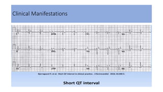 Clinical Manifestations
 