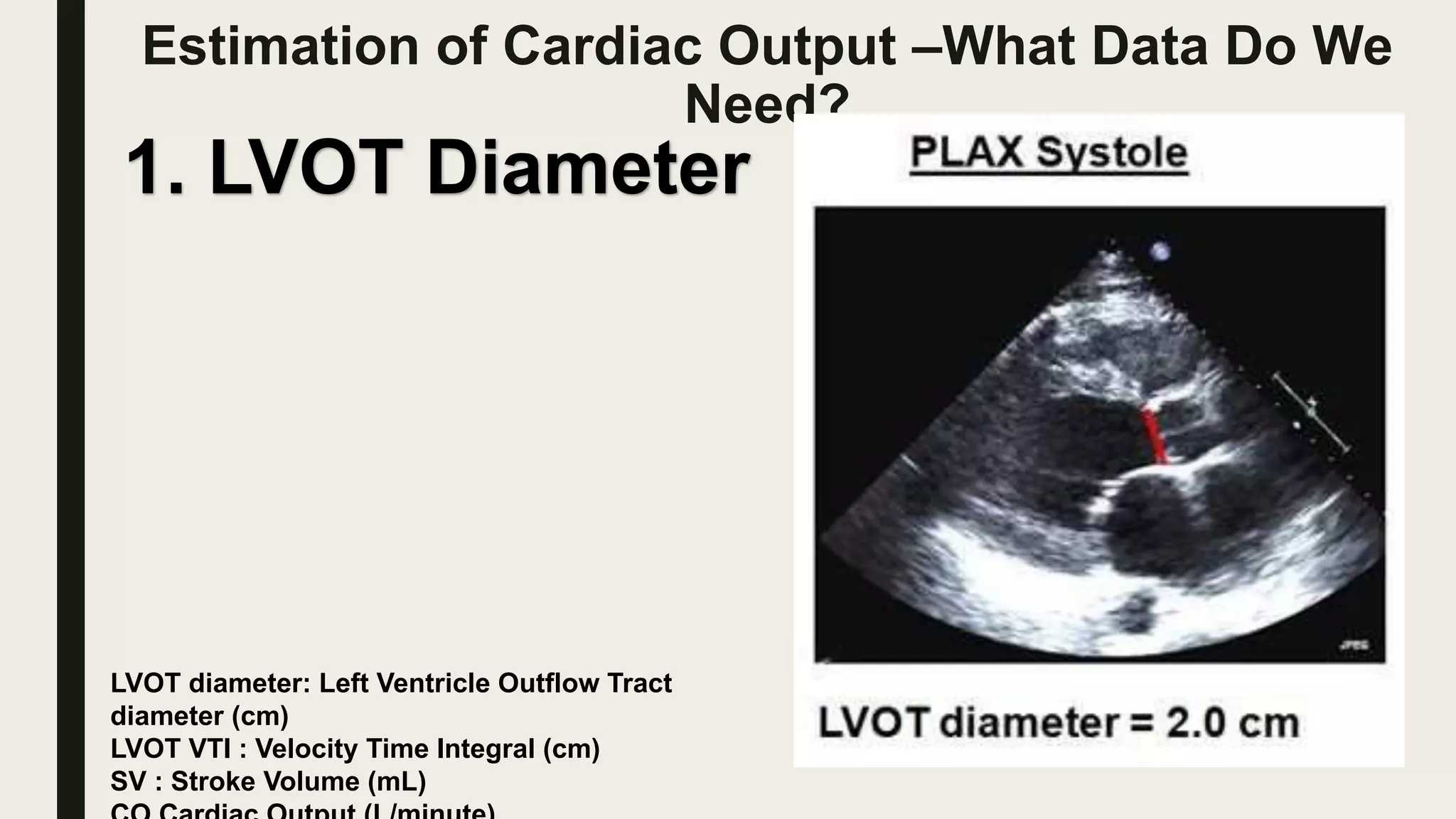 Estimation of Cardiac Output –What Data Do We
Need?
1. LVOT Diameter
LVOT diameter: Left Ventricle Outflow Tract
diameter (cm)
LVOT VTI : Velocity Time Integral (cm)
SV : Stroke Volume (mL)
 