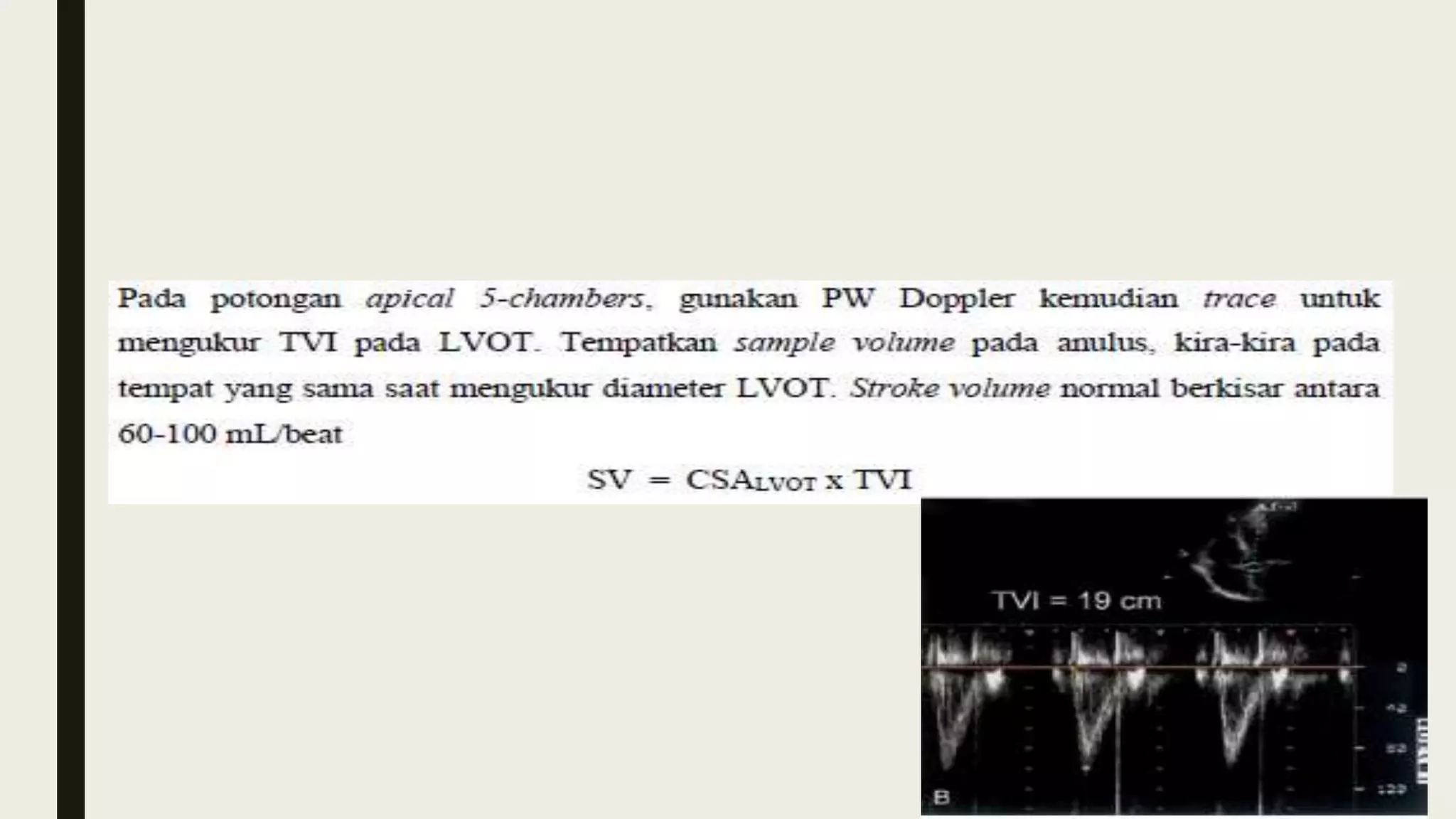 ■ Menghitung stroke volume (SV)
 