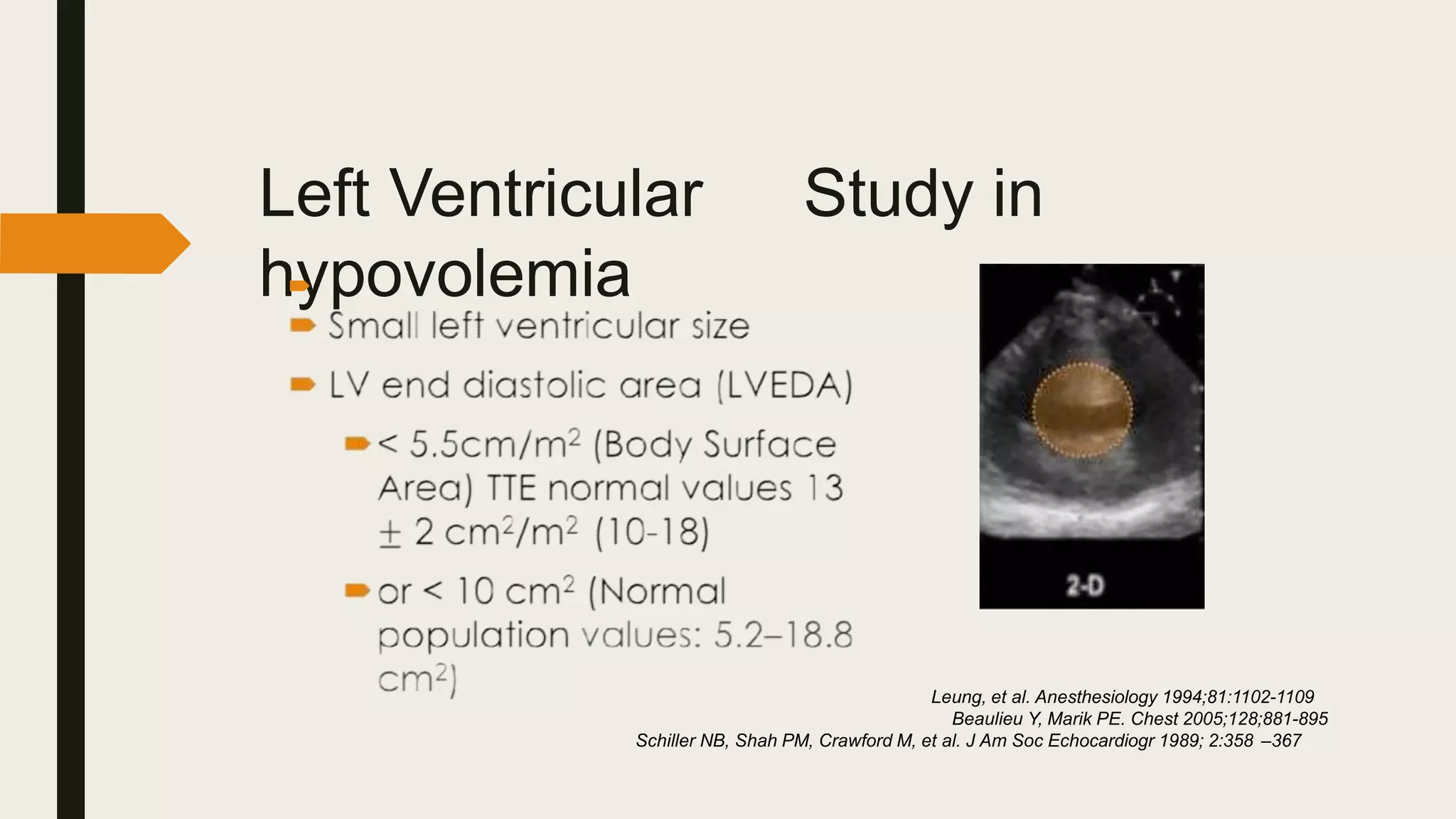 Left Ventricular Study in
hypovolemia

Leung, et al. Anesthesiology 1994;81:1102-1109
Beaulieu Y, Marik PE. Chest 2005;128;881-895
Schiller NB, Shah PM, Crawford M, et al. J Am Soc Echocardiogr 1989; 2:358 –367
 