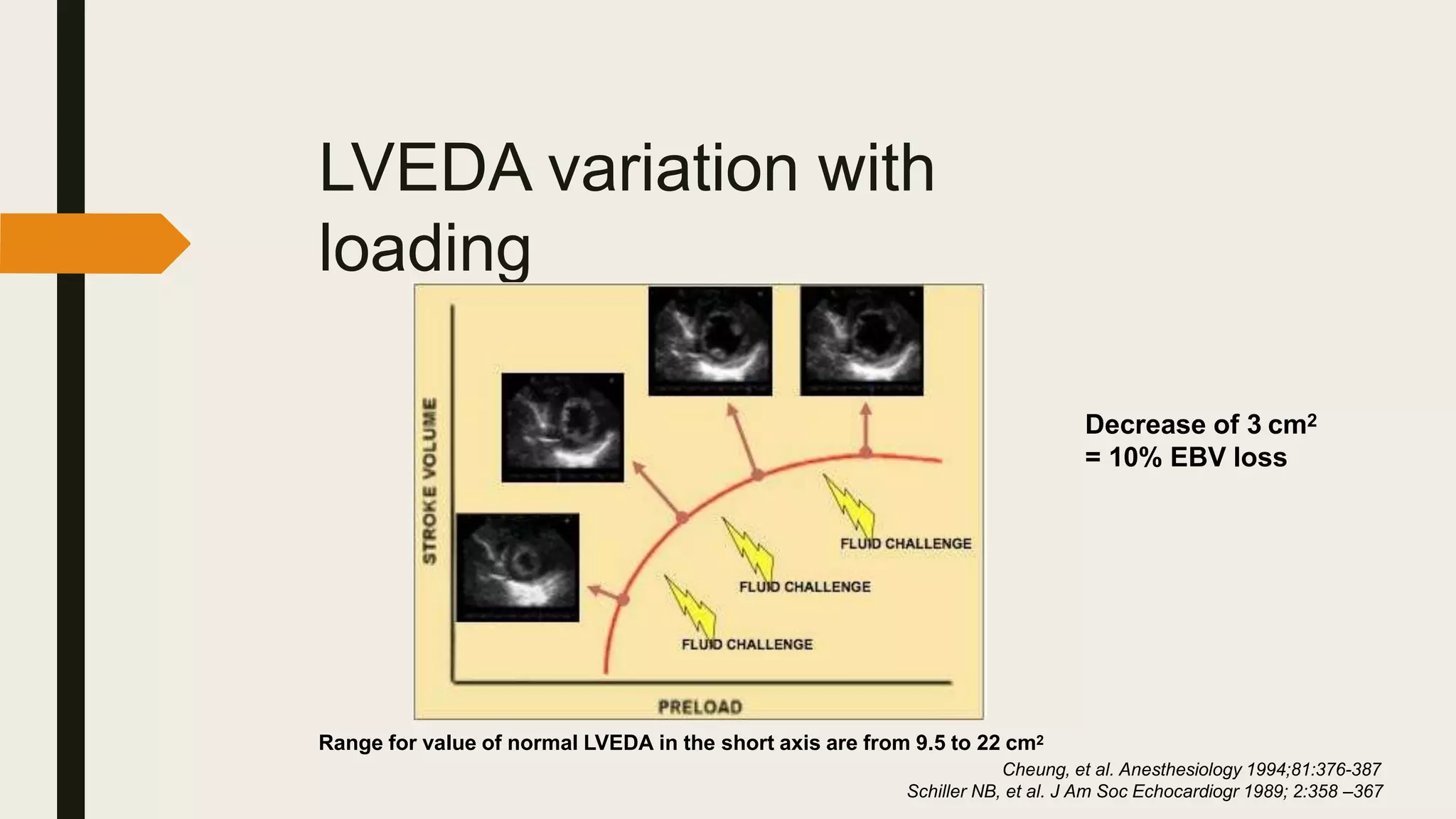 LVEDA variation with
loading
Range for value of normal LVEDA in the short axis are from 9.5 to 22 cm2
Cheung, et al. Anesthesiology 1994;81:376-387
Schiller NB, et al. J Am Soc Echocardiogr 1989; 2:358 –367
Decrease of 3 cm2
= 10% EBV loss
 