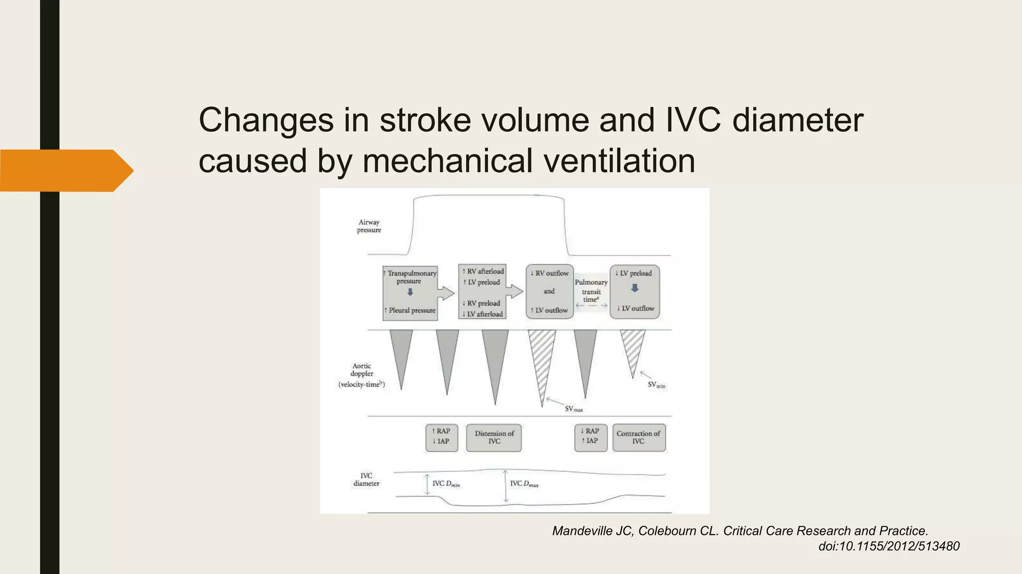 Changes in stroke volume and IVC diameter
caused by mechanical ventilation
Mandeville JC, Colebourn CL. Critical Care Research and Practice.
doi:10.1155/2012/513480
 