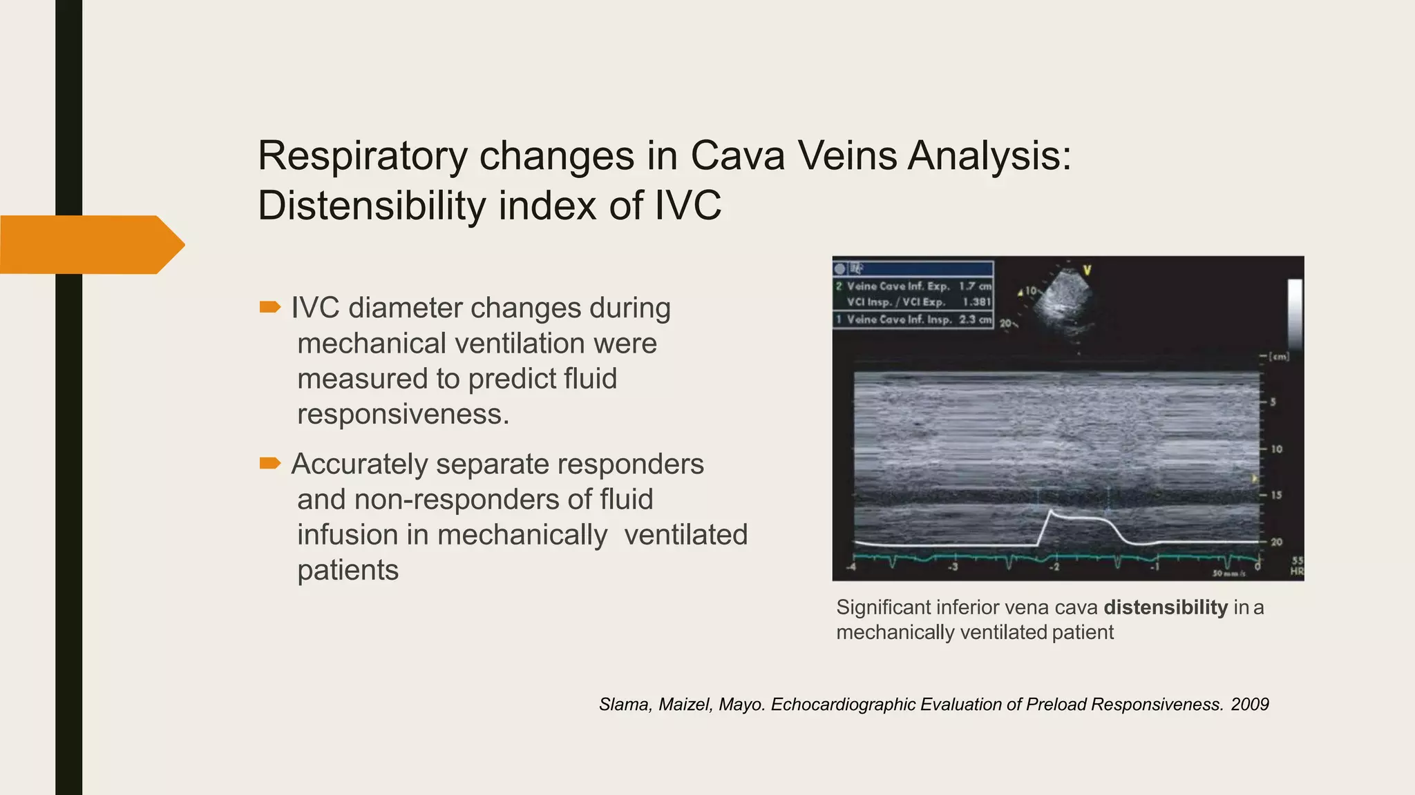 Respiratory changes in Cava Veins Analysis:
Distensibility index of IVC
 IVC diameter changes during
mechanical ventilation were
measured to predict fluid
responsiveness.
 Accurately separate responders
and non-responders of fluid
infusion in mechanically ventilated
patients
Significant inferior vena cava distensibility in a
mechanically ventilated patient
Slama, Maizel, Mayo. Echocardiographic Evaluation of Preload Responsiveness. 2009
 