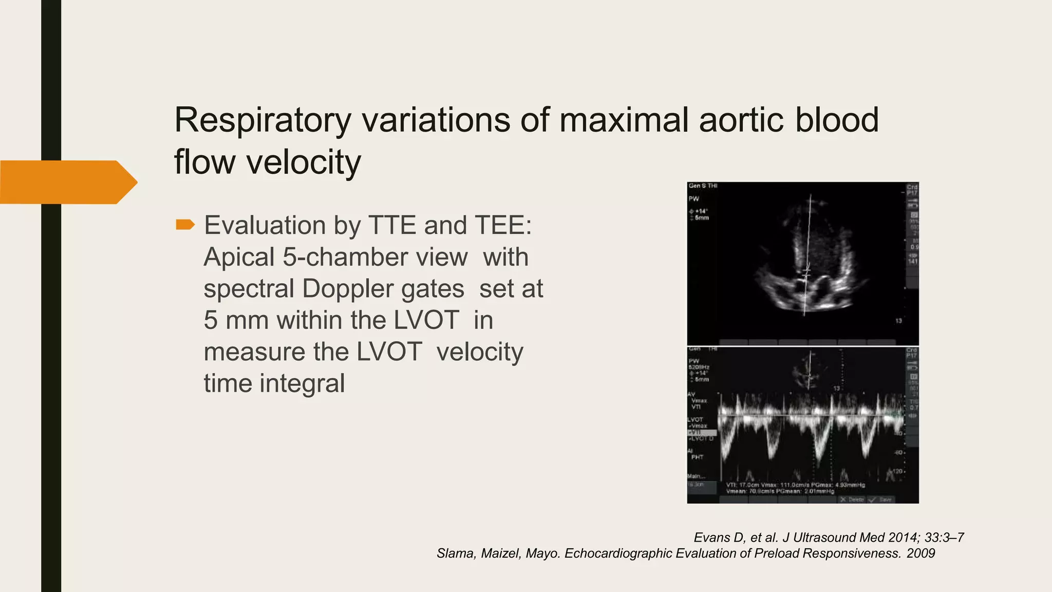 Respiratory variations of maximal aortic blood
flow velocity
 Evaluation by TTE and TEE:
Apical 5-chamber view with
spectral Doppler gates set at
5 mm within the LVOT in
measure the LVOT velocity
time integral
Evans D, et al. J Ultrasound Med 2014; 33:3–7
Slama, Maizel, Mayo. Echocardiographic Evaluation of Preload Responsiveness. 2009
 