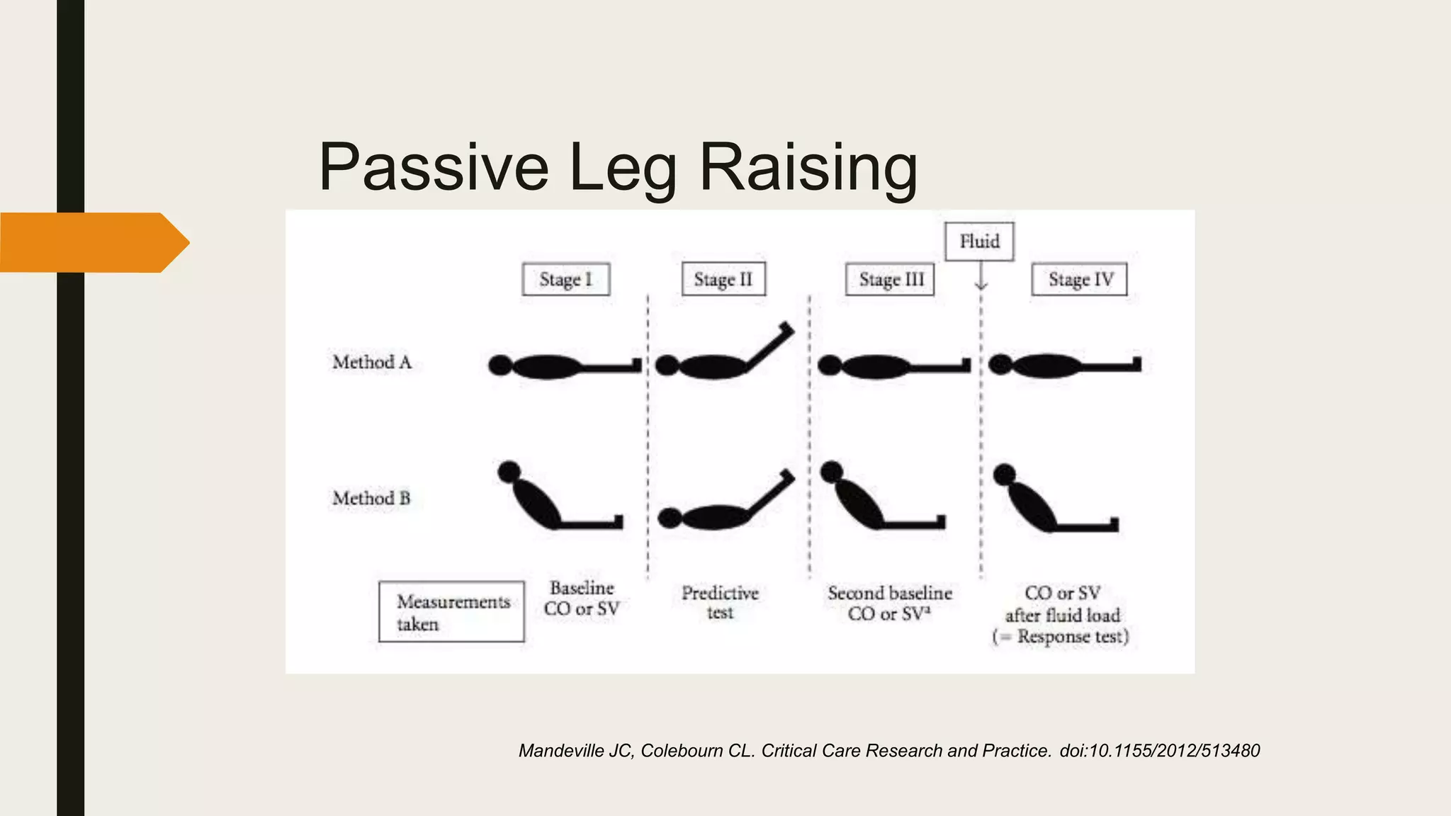 Passive Leg Raising
(PLR) test
Mandeville JC, Colebourn CL. Critical Care Research and Practice. doi:10.1155/2012/513480
 