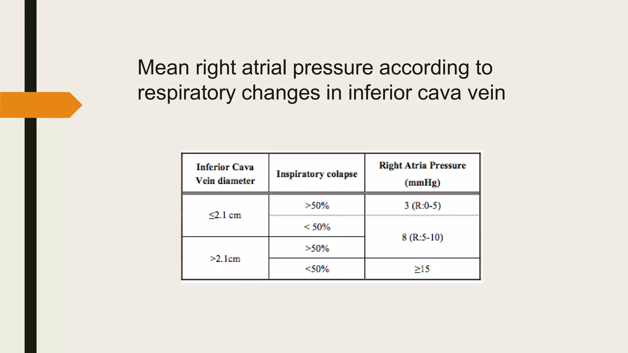 Mean right atrial pressure according to
respiratory changes in inferior cava vein
 