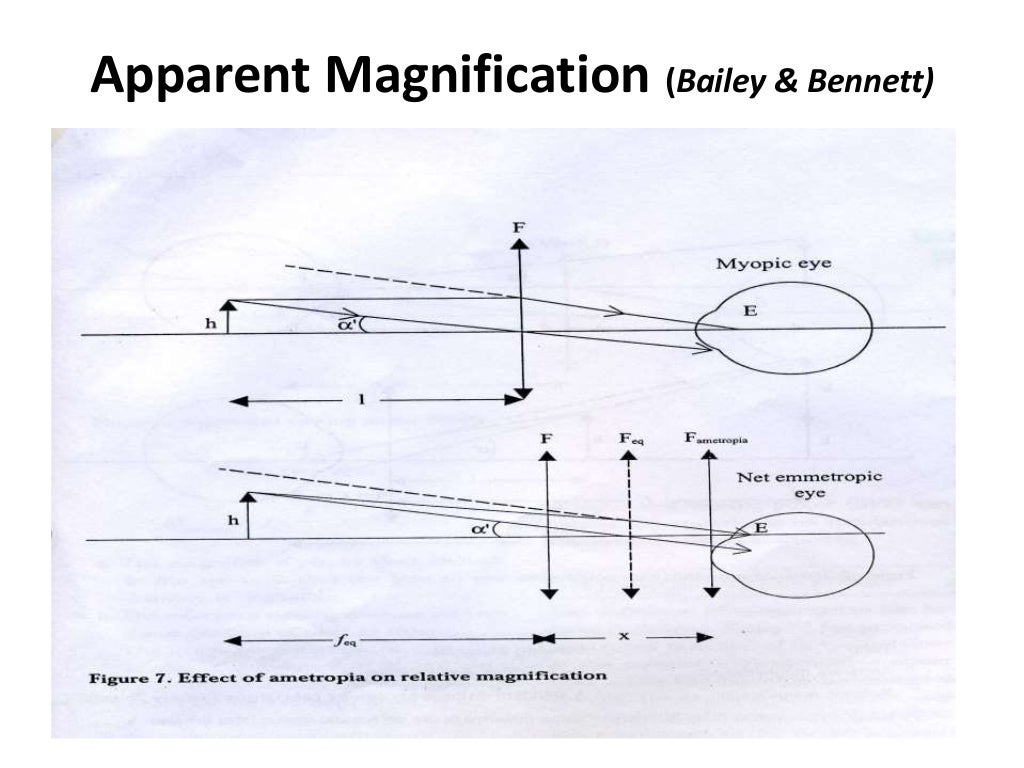 Calculation of magnification in low vision
