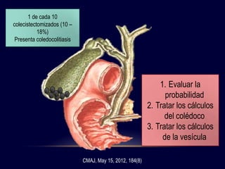 Obstrucción biliar
Colangitis
Pancreatitis
Cirrosis biliar secundaria
1 de cada 10
colecistectomizados (10 –
18%)
Presenta coledocolitiasis
1. Evaluar la
probabilidad
2. Tratar los cálculos
del colédoco
3. Tratar los cálculos
de la vesícula
CMAJ, May 15, 2012, 184(8)
 