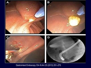 Gastrointest Endoscopy Clin N Am 23 (2013) 251–275
 