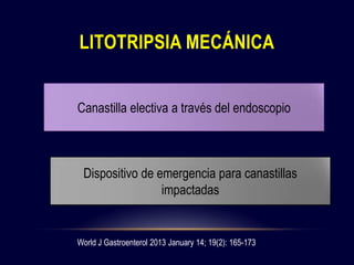World J Gastroenterol 2013 January 14; 19(2): 165-173
LITOTRIPSIA MECÁNICA
Canastilla electiva a través del endoscopio
Dispositivo de emergencia para canastillas
impactadas
 