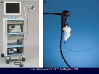 J Interv Gastroenterol1:2, 70-77; April/May/June 2011
 