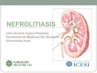 NEFROLITIASIS
Jairo Andrés Castro Peñaloza
Estudiante de Medicina 6to Semestre
Universidad Icesi
 