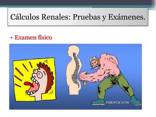 Cálculos Renales: Pruebas y Exámenes.
• Examen físico
 