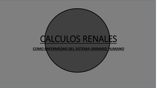 CALCULOS RENALES
COMO ENFERMEDAD DEL SISTEMA URINARIO HUMANO
 