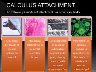 Attachment
by means of
organic
pellicle on
enamel
Mechanical
interlocking in
cemental
resorption
lacunae
Close adaptation
of calculus
undersurface
depressions to
gently sloping
mounds on the
unaltered
cementum surface.
Penetration of
calculus
bacteria in
cementum. But
this mode of
attachment
was not
acknowledged
The following 4 modes of attachment has been described:-
34
 
