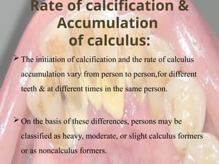 Calculus- Calcification of the plaque maturation | PPTX