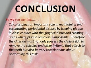 Calculus- Calcification of the plaque maturation | PPTX