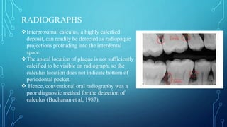 Dental calculus PERIODONTICS HARD DEPOIST | PPTX