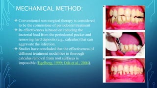 Dental calculus PERIODONTICS HARD DEPOIST | PPTX