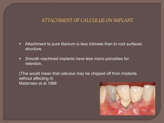 Dental Calculus ppt | PPTX