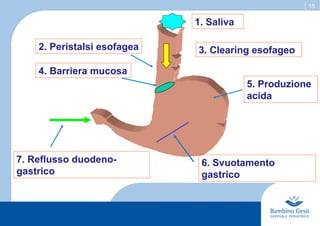 15
2. Peristalsi esofagea
6. Svuotamento
gastrico
7. Reflusso duodeno-
gastrico
4. Barriera mucosa
5. Produzione
acida
3. Clearing esofageo
1. Saliva
 