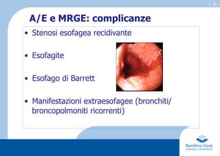 19
A/E e MRGE: complicanze
•  Stenosi esofagea recidivante
•  Esofagite
•  Esofago di Barrett
•  Manifestazioni extraesofagee (bronchiti/
broncopolmoniti ricorrenti)
 