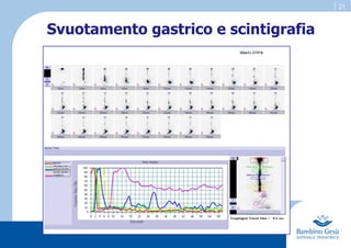 21
Svuotamento gastrico e scintigrafia
 