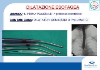 4
DILATAZIONE ESOFAGEA
QUANDO: IL PRIMA POSSIBILE > processo cicatriziale
CON CHE COSA: DILATATORI SEMIRIGIDI O PNEUMATICI
 