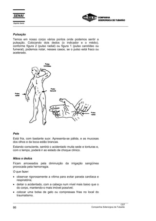 Espírito Santo
___________________________________________________________________________________________________



Pulsação
Temos em nosso corpo vários pontos onde podemos sentir a
pulsação. Colocando dois dedos (o indicador e o médio),
conforme figura 2 (pulso radial) ou figura 1 (pulso carotídeo ou
fumeral), podemos notar, nesses casos, se o pulso está fraco ou
acelerado.




Pele
Está fria, com bastante suor. Apresenta-se pálida, e as mucosas
dos olhos e da boca estão brancas.
Estando consciente, sentirá o acidentado muita sede e tonturas e,
com o tempo, poderá ir ao estado de choque clínico.

Mãos e dedos
Ficam arroxeados pela diminuição da irrigação sangüínea
provocada pela hemorragia.
O que fazer:
• observar rigorosamente a vítima para evitar parada cardíaca e
  respiratória;
• deitar o acidentado, com a cabeça num nível mais baixo que o
  do corpo, mantendo-o mais imóvel possível;
• colocar uma bolsa de gelo ou compressas frias no local do
  traumatismo.

___________________________________________________________________________________________________
                                                                                               CST
86                                                                 Companhia Siderúrgica de Tubarão
 