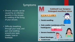 Symptoms
• Chronic sinusitis can be
caused by an infection,
growths in the sinuses
or swelling of the lining
of your sinuses.
• Difficulty breathing
through your nose, and
pain and swelling
around your eyes,
cheeks, nose or
forehead.
 