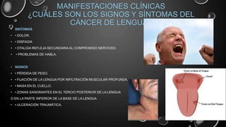 MANIFESTACIONES CLÍNICAS
¿CUÁLES SON LOS SIGNOS Y SÍNTOMAS DEL
CÁNCER DE LENGUA?
• SINTOMAS
• • DOLOR.
• • DISFAGIA
• • OTALGIA REFLEJA SECUNDARIA AL COMPROMISO NERVIOSO.
• • PROBLEMAS DE HABLA.
• SIGNOS
• • PÉRDIDA DE PESO.
• • FIJACIÓN DE LA LENGUA POR INFILTRACIÓN MUSCULAR PROFUNDA.
• • MASA EN EL CUELLO.
• • ZONAS SANGRANTES EN EL TERCIO POSTERIOR DE LA LENGUA
O EN LA PARTE INFERIOR DE LA BASE DE LA LENGUA
• • ULCERACIÓN TRAUMÁTICA.
 