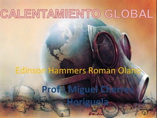 Edinson Hammers Roman Olano
Prof.: Miguel Cherres
Horiguela
 