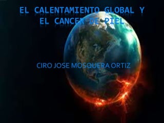 EL CALENTAMIENTO GLOBAL Y
EL CANCER DE PIEL
CIRO JOSE MOSQUERA ORTIZ
 