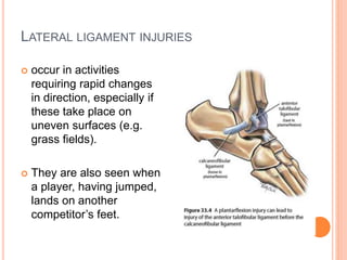 LATERAL LIGAMENT INJURIES
 occur in activities
requiring rapid changes
in direction, especially if
these take place on
uneven surfaces (e.g.
grass fields).
 They are also seen when
a player, having jumped,
lands on another
competitor’s feet.
 
