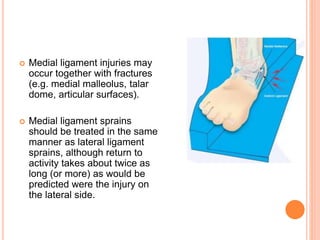  Medial ligament injuries may
occur together with fractures
(e.g. medial malleolus, talar
dome, articular surfaces).
 Medial ligament sprains
should be treated in the same
manner as lateral ligament
sprains, although return to
activity takes about twice as
long (or more) as would be
predicted were the injury on
the lateral side.
 
