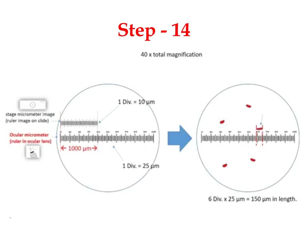 Calibration of eyepice micrometer with stage micrometer