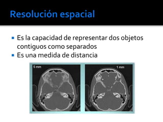 Calidad De Imagen Radiogr fica PPTX calidad-de-imagen-radiogr-fica-pptx