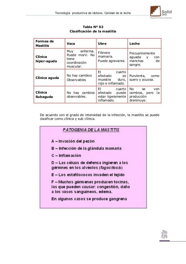 La Leche - 45 La Leche - 45