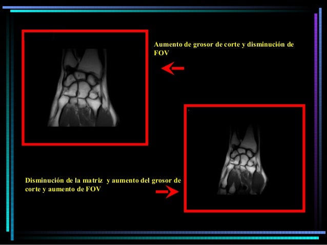 Calidad imagen en Resonancia Magnética
