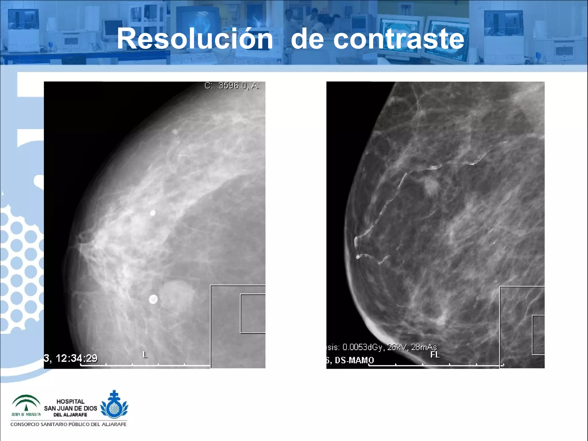 Resolución de contraste
 