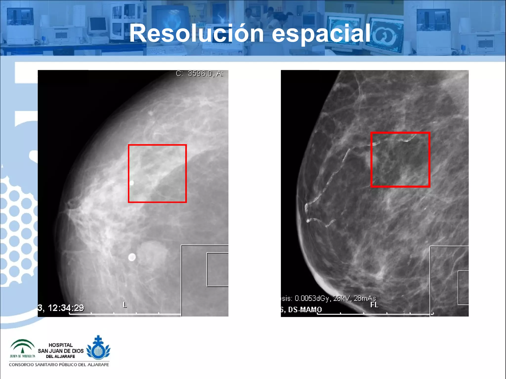 Resolución espacial
 