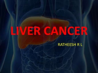 LIVER CANCER
RATHEESH R L
 