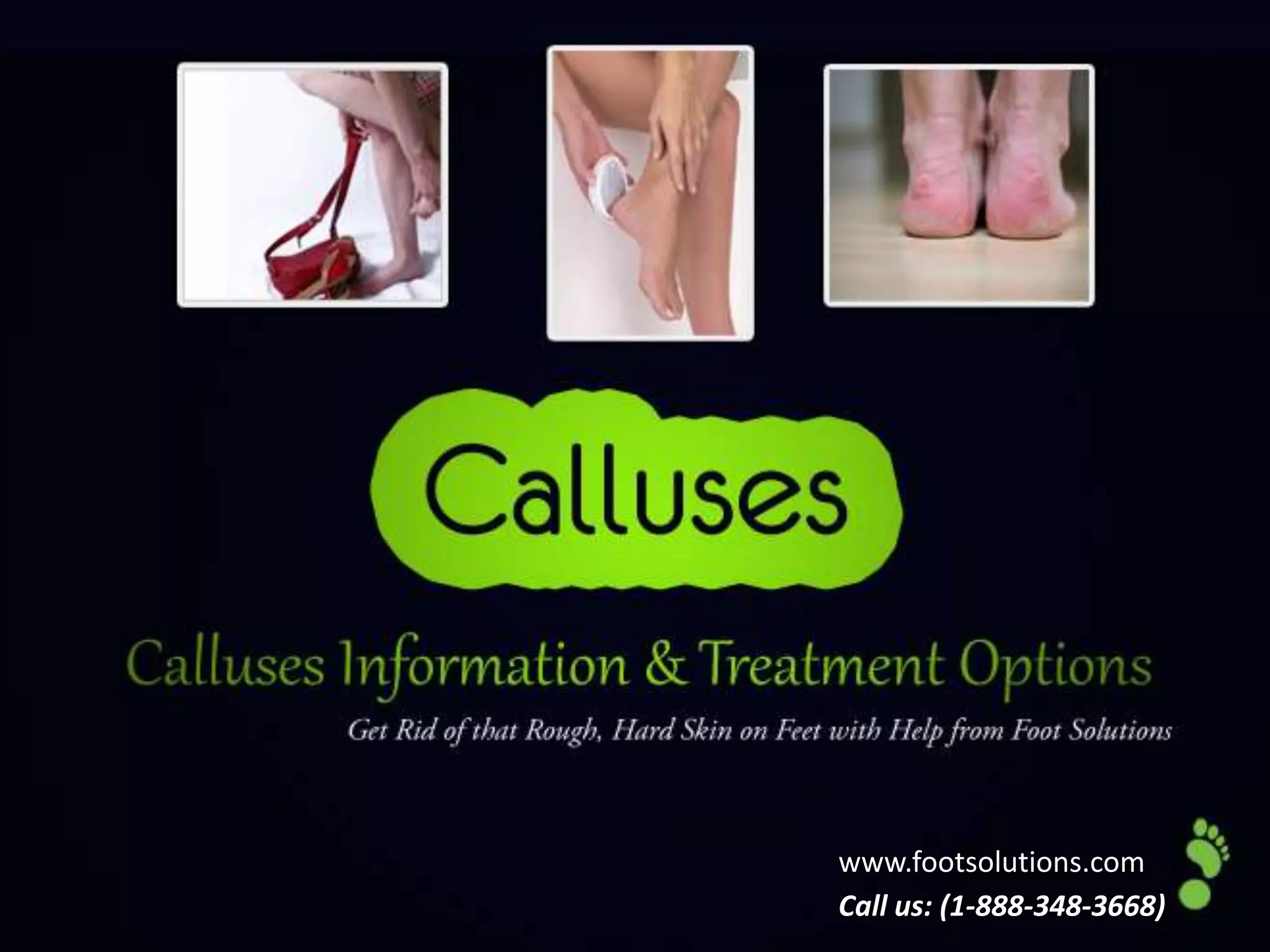 Are Hard Calluses A Sign Of Cancer? – SCOSZD