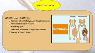 OSTEOMALACIA
CLINICAL FEATURES
 Pain and Chronic fatigue, starting insidiously.
 Proximal muscles weakness.
 Waddling gait.
 Deformed pelvis and exaggerated lordosis.
 Bowing of Lower limbs
 