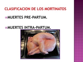 MUERTES

PRE-PARTUM.

MUERTES

INTRA-PARTUM.

 